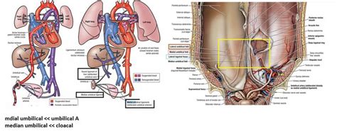 Urachus Median Umbilical Ligament