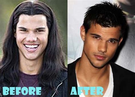 Taylor Lautner Plastic Surgery Before and After Nose Job - Lovely Surgery