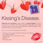 Kissing’s Disease – Arik Delacruz