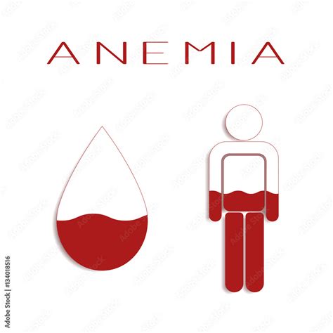 Anemia. Vector illustration. Stock Vector | Adobe Stock