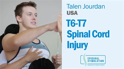 T6-T7 Spinal Cord Injury Patient Talen from USA receives Epidural Stimulation Treatment - YouTube