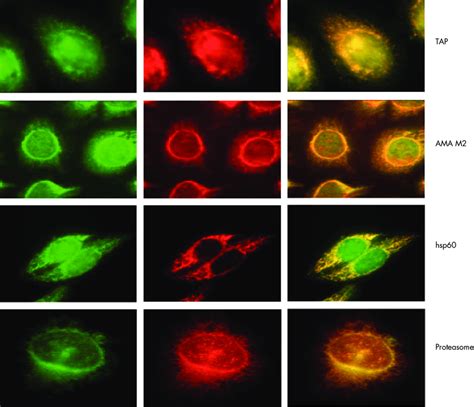 Double stains by directly fluorescein isothiocyanate-labelled ...