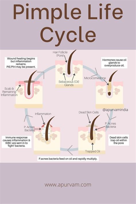 Healthy Skin Tips: Understanding the Pimple Life Cycle