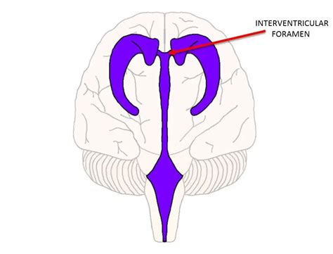 Interventricular foramen - definition