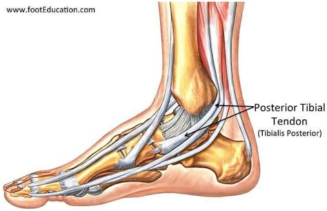 Tibialis Posterior Tendinopathy - Pain around inside ankle bone - Fit Feet Podiatry