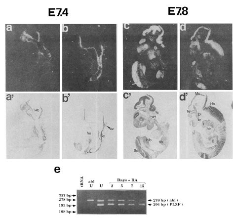 Figure 10 from Developmental analysis of murine Promyelocyte Leukemia ...