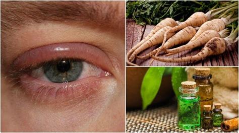 5 Home Remedies for Swollen Eyelids - Step to Health