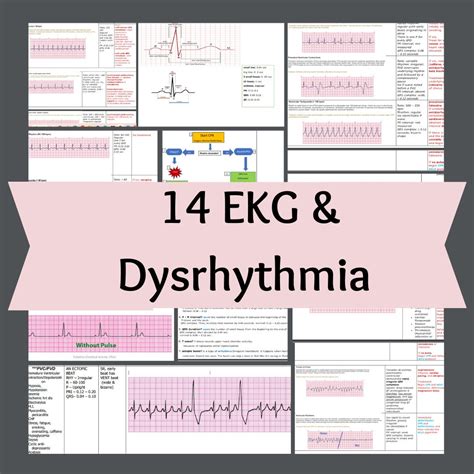 14 EKG Cardiac Rhythm and Dysrhythmias & ACLS Algorithm Cheat - Etsy