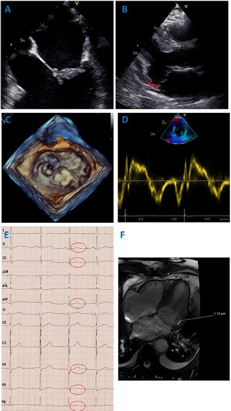 Demonstrating the clinical findings in this patient. A Thickening of... | Download Scientific ...