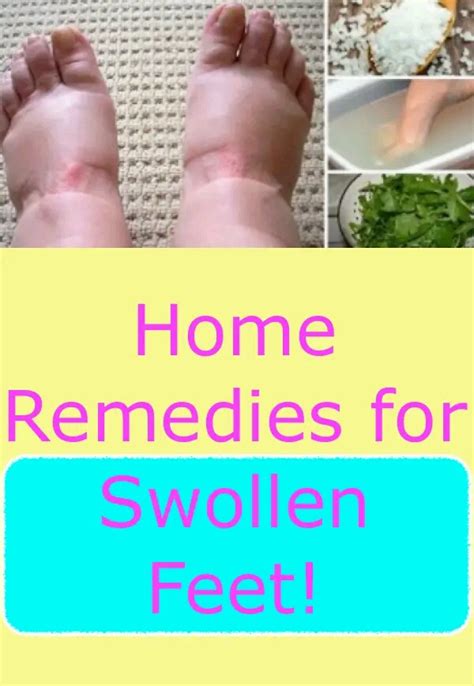 Home Remedies for Swollen Feet - ThingsCouplesDo