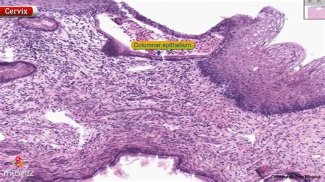 Histology of cervix - Shotgun Histology - YouTube