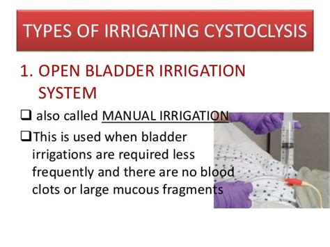 Cystoclysis bladder irrigation