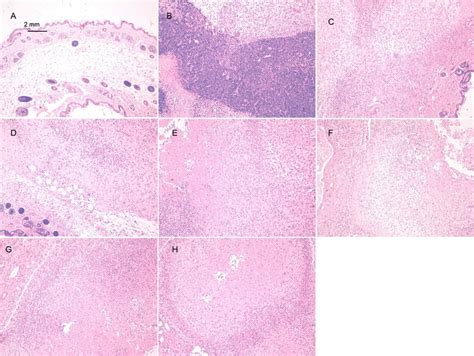 Histopathological examination of the inoculation site of NOD SCID mice ...