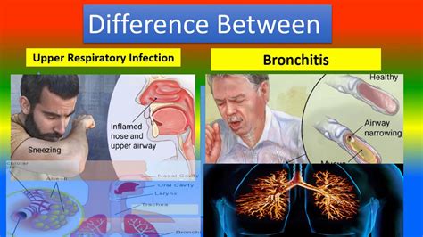 DIFFERENCE BETWEEN UPPER RESPIRATORY INFECTION AND BRONCHITIS - YouTube