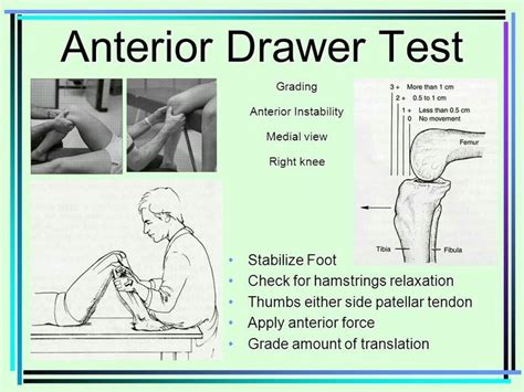 Anterior Drawer Test