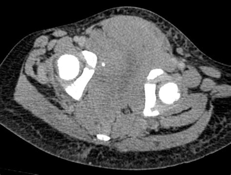 👩‍⚕️💻📊 They say patients come in pairs! I5-year-old patient who presented with pain in the ...