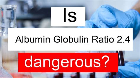 Is Albumin Globulin ratio 2.4 high, normal or dangerous? What does A/G ratio level 2.4 mean?