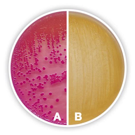 MacConkey Agar- Composition, Principle, Uses, Preparation, 44% OFF