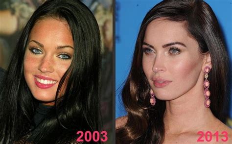 Megan Fox - Are plastic surgery rumors true?