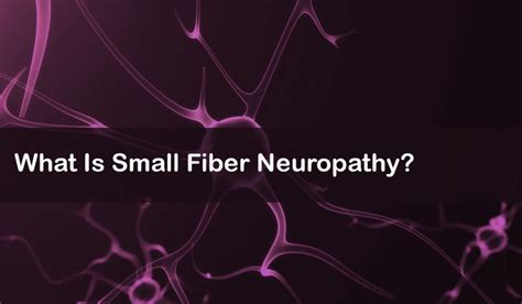 What Is Small Fiber Neuropathy: Symptoms, Treatment, Causes, and More