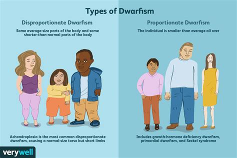 Dwarfism - Symptoms and Impacts