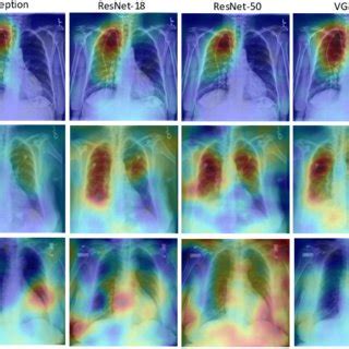 RISE [16] based saliency map visualization for each CNN. The abnormal... | Download Scientific ...