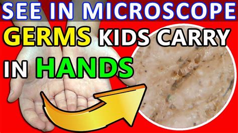 See in Microscope | The Germs Kids Carry in Hands after Playing - YouTube