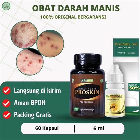 Jual Proskin - Obat Darah Manis, Obat prurigo, Obat Korengan, Salep darah manis di kaki, Obat ...