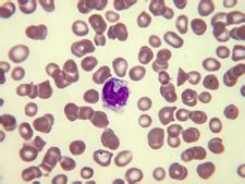 Basophilic Myelocyte