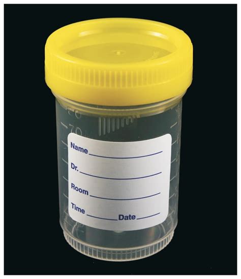 Parter Medical Products™ Nonsterile Specimen Containers | Fisher Scientific