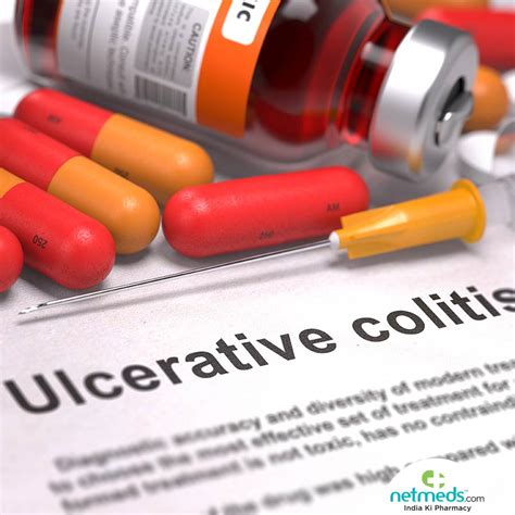 Ulcerative Colitis: Types, Symptoms And Treatment