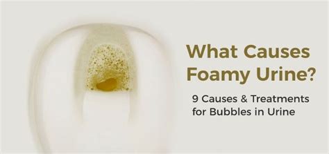 9 Possible Causes of Foamy Urine and How Is It Treated | Urinal, Foamy ...