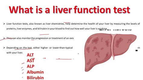 Liver Function test explained | ALT AST ALP Albumin Bilirubin Test ...