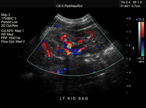 Wie funktionieren Ultraschall-Scans? - DEMedBook