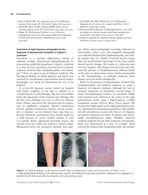 (PDF) Usefulness of high-frequency sonography for the diagnosis of asymptomatic myopathy in ...