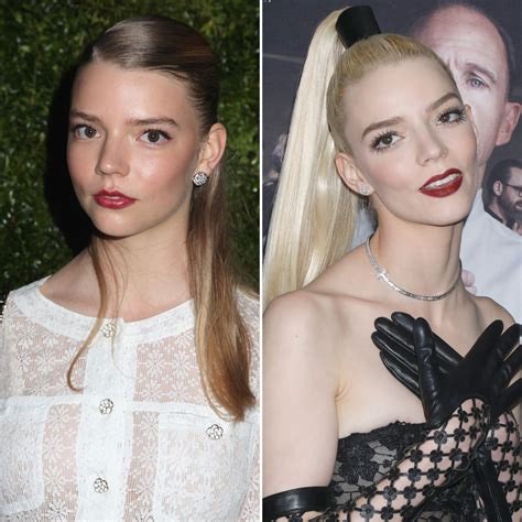 Did Anya Taylor-Joy Get Plastic Surgery? Quotes, Photos | Life & Style