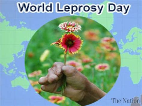 World Leprosy Day - 28 January - Image-i-nations