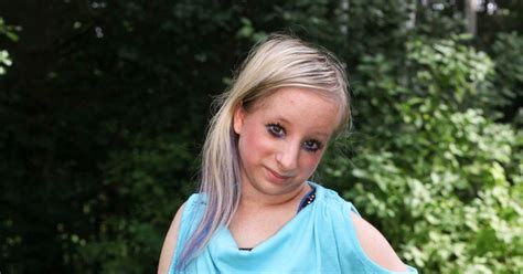 'It Doesn't Mean I'm Any Different': Teen Born With Primordial Dwarfism ...