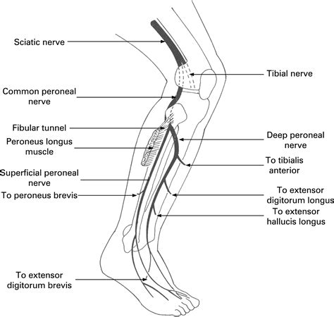 Common Peroneal Nerve - Stepwards