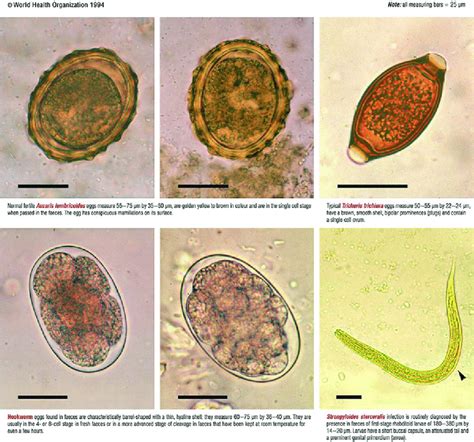 Parasites In Stool Microscope
