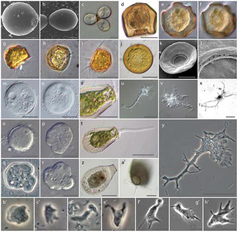 Morphology of the amoeboid lineages isolated for this study. 1a–c.... | Download Scientific Diagram