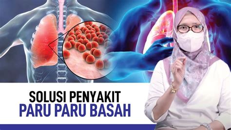 Paru-Paru Basah (Pneumonia): Penyebab, Gejala dan Cara Mengatasinya | Kata Dokter - YouTube