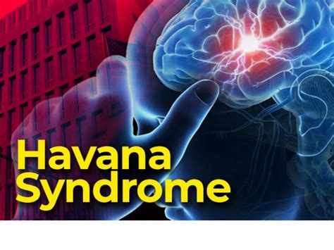 What is Havana Syndrome? Know Causes and Symptoms