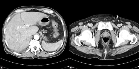 Triple phase contrast-enhanced axial computed tomography scan of... | Download Scientific Diagram