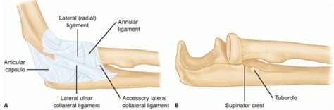 Lateral Collateral Ligament Reconstruction of the Elbow | Musculoskeletal Key