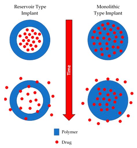 Polymers | Free Full-Text | Implantable Polymeric Drug Delivery Devices ...