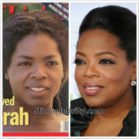 Oprah Winfrey Nose Job Plastic Surgery Before and After (Star plastic ...