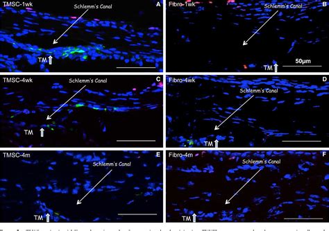 Figure 5 from Stem cells from trabecular meshwork home to TM tissue in vivo. | Semantic Scholar