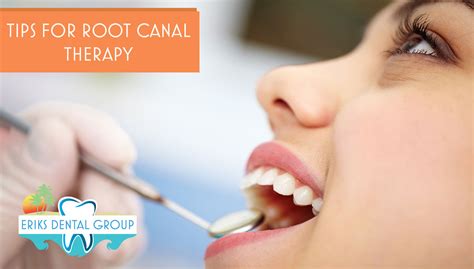 Tips For Successful Recovery After A Root Canal Treatment