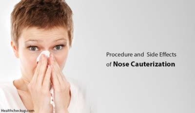 Precautions, Procedure and Side Effects of Nose Cauterization